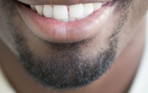 Der Henriquatre-Bart: Zu wem er passt und wie du ihn wachsen lassen kannst
